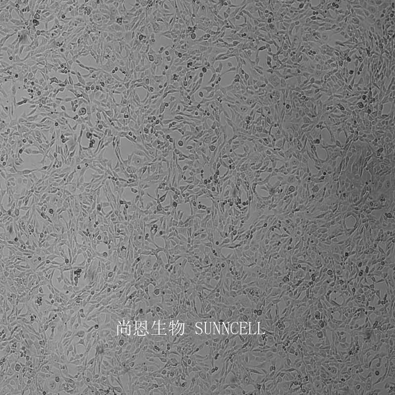 逆转录病毒包被的NIH3T3细胞