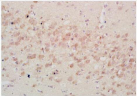 Anti-IGFBP3 antibody-胰岛素样生长因子结合蛋白3抗体