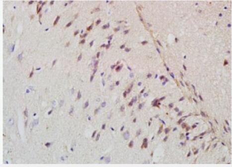 Anti-Amyloid Precursor Protein antibody-APP/ABPP淀粉样肽前体蛋白抗体