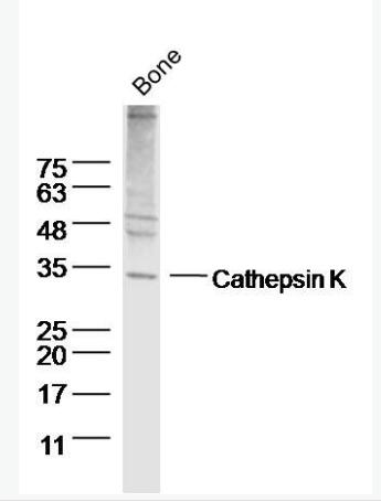 Anti-Cathepsin K antibody-组织蛋白酶K抗体