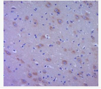 Anti-EGF  antibody-表皮生长因子抗体