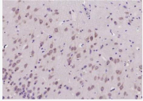 Anti-B3GAT1  antibody-髓鞘相关糖蛋白（CD57）抗体
