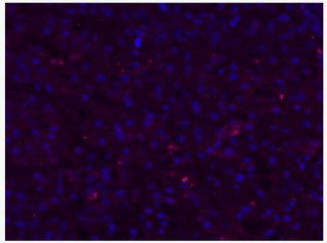 Anti-HBsAg antibody-山羊抗人乙肝表面抗原抗体（包被）