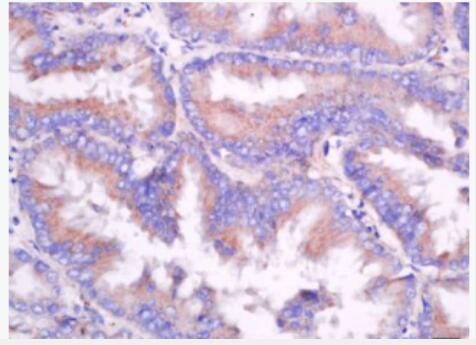 Anti-CD55 antibody-衰变加速因子CD55抗体