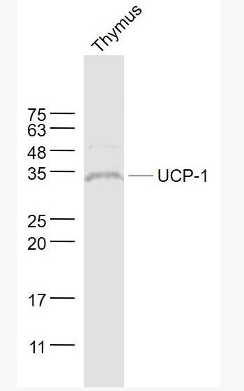 Anti-UCP-1 antibody-线粒体脱偶连蛋白1抗体