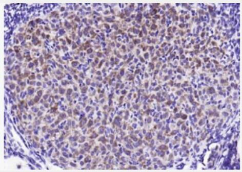 Anti-STMN1 antibody-白血病相关蛋白18/癌蛋白18抗体