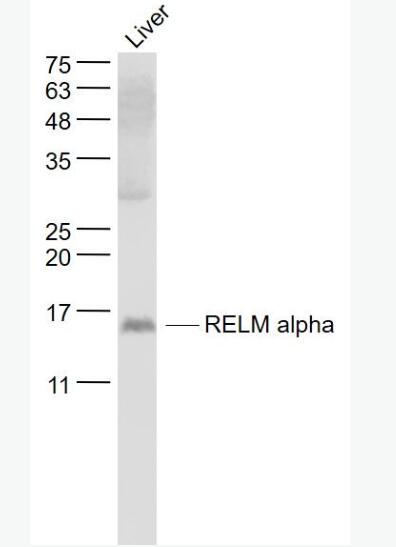 Anti-RELM alpha antibody-抵抗素样分子α抗体