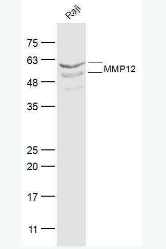Anti-MMP12 antibody-基质金属蛋白酶-12抗体