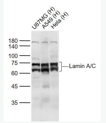 Anti-Lamin A/C  antibody-核纤层蛋白A抗体