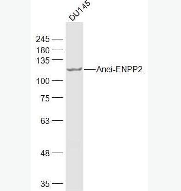 Anti-ENPP2 antibody-自分泌运动因子抗体