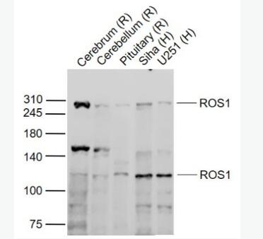 Anti-ROS1  antibody-原癌基因ROS1抗体