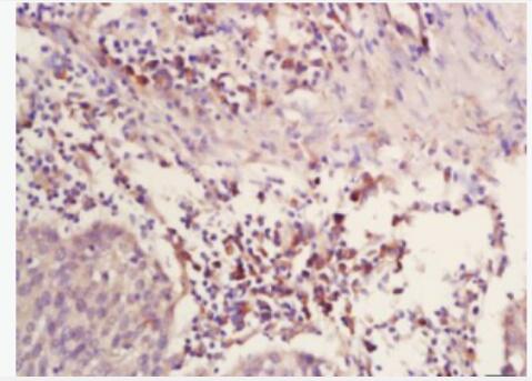 Anti-ATP5A antibody-ATP5A抗体