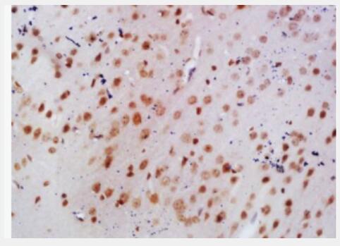 Anti-EEF1A1 antibody-翻译延伸因子EF-1a抗体