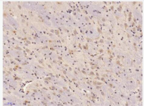Anti-KLK7 antibody-激肽释放酶7抗体