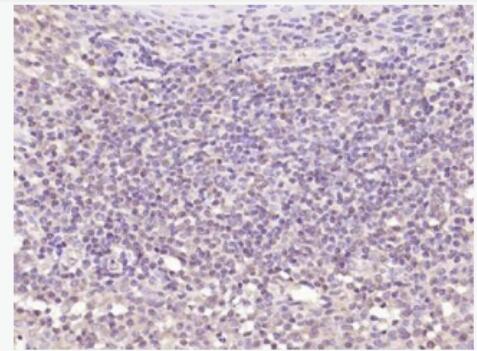 Anti-IL15RA antibody-白介素15受体α抗体