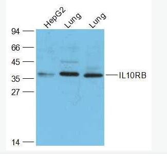 Anti-IL10RB antibody-白细胞介素-10受体β抗体