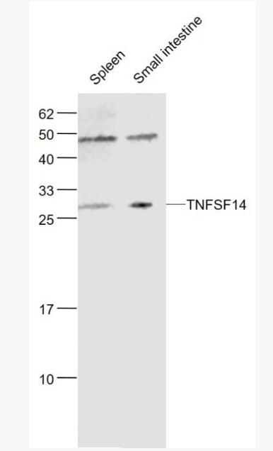 Anti-TNFSF14 antibody-肿瘤坏死因子配体超家族成员14抗体