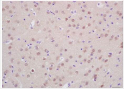 Anti-prox1 antibody-prox-1抗体