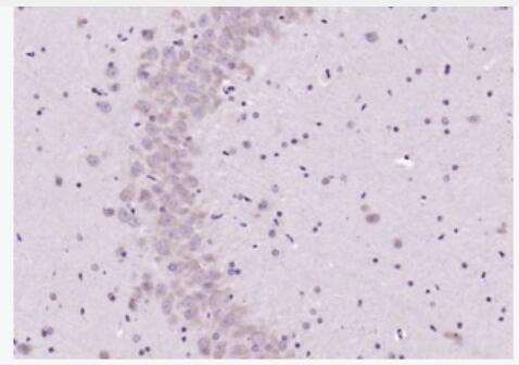 Anti-GABA antibody-γ氨基丁酸抗体