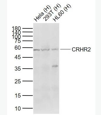 Anti-CRHR2 antibody-促肾上腺皮质释放激素受体2抗体