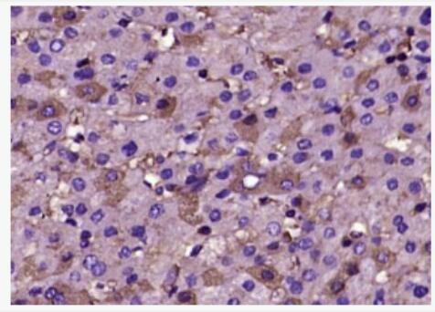 Anti-human Fibrinogen antibody-人纤维蛋白原抗体