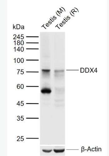 Anti-DDX4 antibody-DDX4抗体