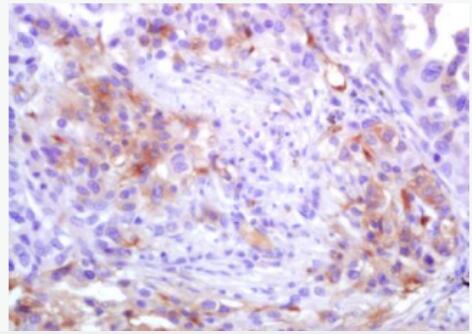 Anti-ADAM10 antibody-去整合素样金属蛋白酶10（CD156c）抗体