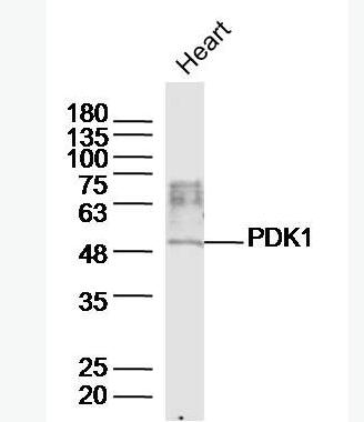 Anti-PDK1/Mitochondrial Pyruvate dehydrogenase kinase 1  antibody-丙酮酸脱氢酶激酶1抗体