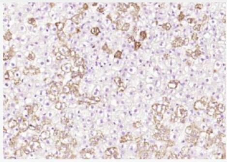 Anti-PNMT antibody-苯乙醇胺甲基转移酶抗体