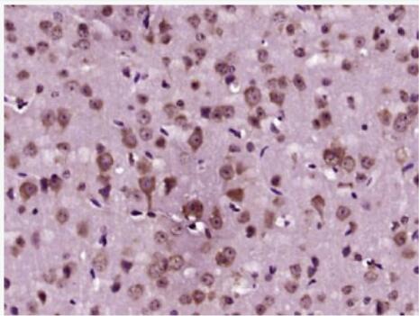 Anti-AANAT antibody-芳香胺N-乙酰化转移酶抗体