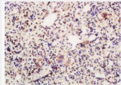 Anti-SLC27A2 antibody-长链脂肪酸辅酶A连接酶抗体