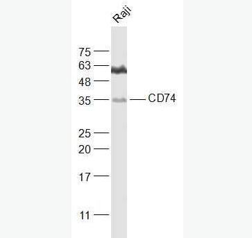 Anti-CD74 antibody-CD74抗体