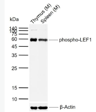 Anti-phospho-LEF1 (Ser42) antibody-磷酸化淋巴增强因子-1抗体
