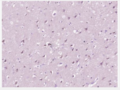 Anti-Coxsackie Adenovirus Receptor antibody-柯萨奇病毒蛋白受体B抗体