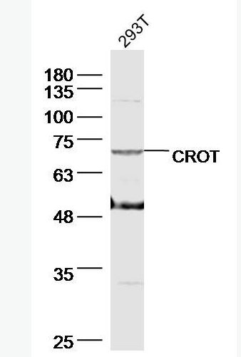 Anti-CROT antibody-肉碱氧位甲基转移酶抗体