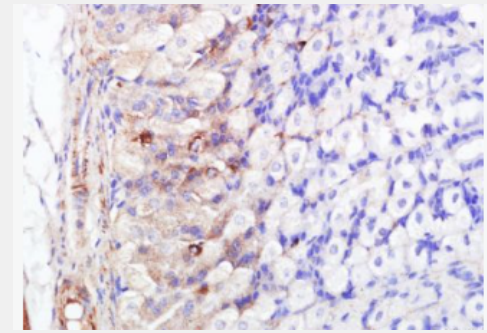 Anti-FABP5 antibody-脂肪酸结合蛋白5/上皮细胞型抗体