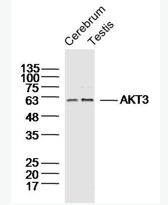 Anti-AKT3 antibody-蛋白激酶B3