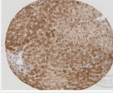 Anti-IGFBP7 antibody-胰岛素样生长因子结合蛋白7抗体