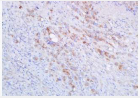 Anti-HLA-A antibody-组织相容性复合体蛋白1抗体