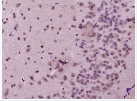 Anti-IDI1  antibody-异戊烯焦磷酸1抗体