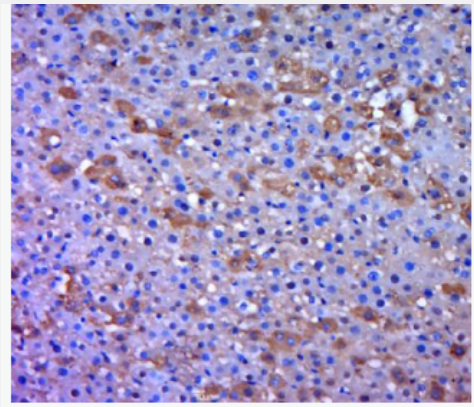Anti-phPhospho-mTOR (Tyr144)antibody-磷酸化雷帕霉素靶蛋白抗体