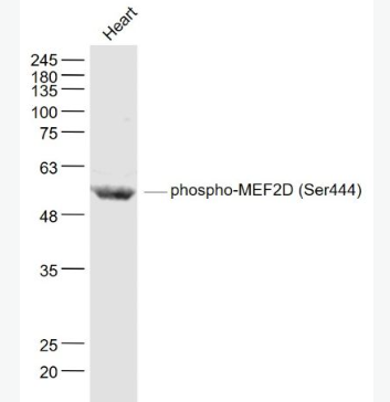Anti-phospho-MEF2D (Ser444)  antibody-磷酸化肌细胞特异性增强因子2D抗体