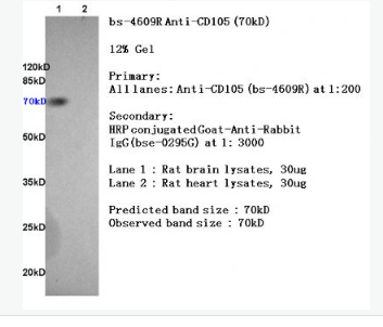 Anti-CD105 antibody-内皮糖蛋白抗体