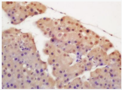 Anti-hnRNP F antibody-异质核糖核蛋白F抗体