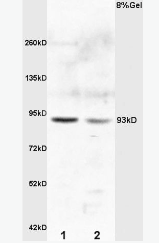 Anti-E2F8  antibody-转录因子E2F8抗体