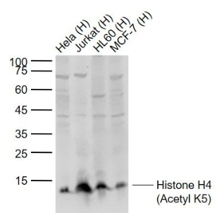 Anti-Histone H4 (Acetyl K5) antibody-乙酰化组蛋白H4抗体