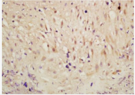 Anti-Phospho-RSK2 (Ser227)  antibody-磷酸化核糖体S6激酶RSK2抗体