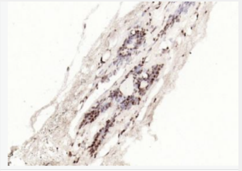 Anti-phospho-STAT3 (Tyr705) antibody-磷酸化信号转导和转录激活因子3单克隆抗体