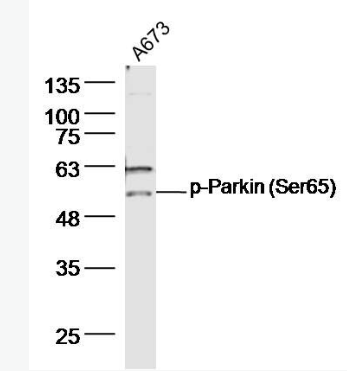 Anti-phospho-Parkin (Ser65)  antibody-磷酸化帕金森病蛋白2抗体