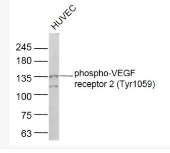 Anti-phospho-VEGF receptor 2 (Tyr1059) antibody-磷酸化血管内皮生长因子受体2抗体